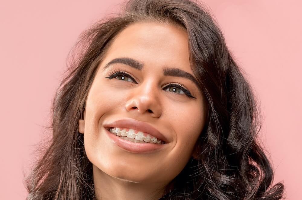 Keramik Brackets